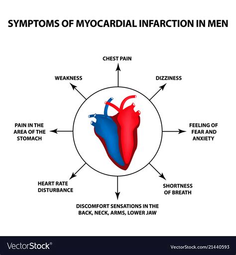 myocardial infarction symptoms
